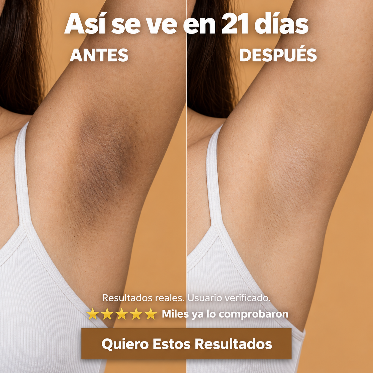 Vitalur™ Gel Corporal | Manchas | Tono Desigual